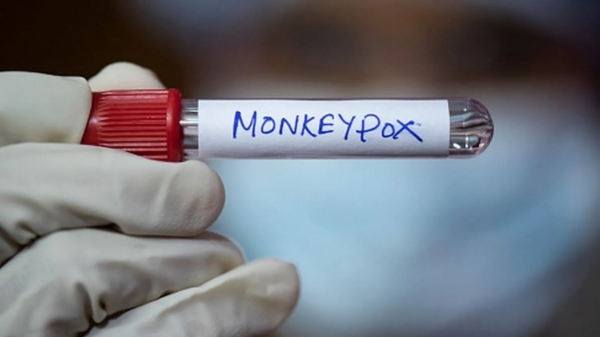 WHO warns of monkeypox outbreak in Africa with more than 14,700 cases